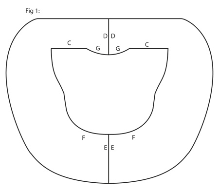 Diagram for DROPS 154-35