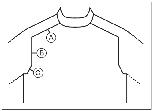Diagram for DROPS 215-21