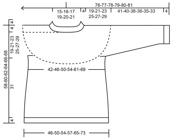 Diagram for DROPS 217-17