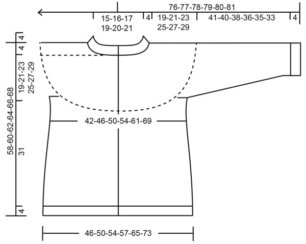 Diagram for DROPS 217-18