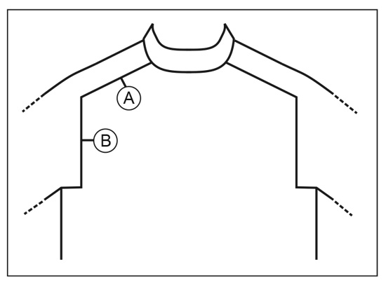 Diagram for DROPS 217-23