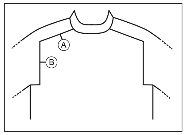 Diagram for DROPS 218-11