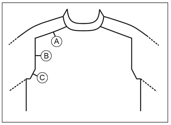 Diagram for DROPS 219-16