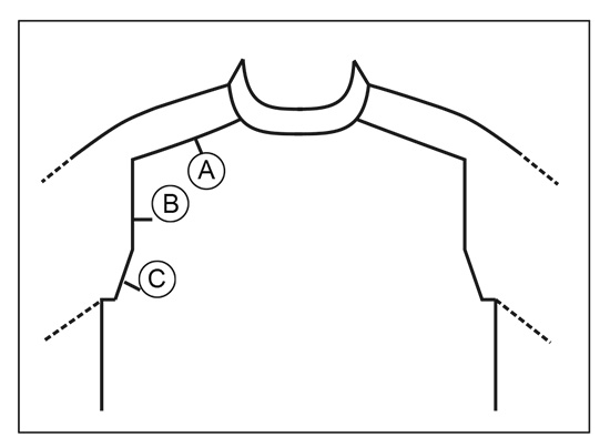 Diagram for DROPS 221-32