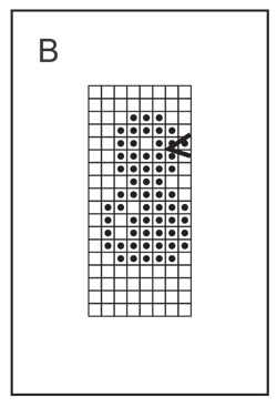 Diagram for DROPS 229-33