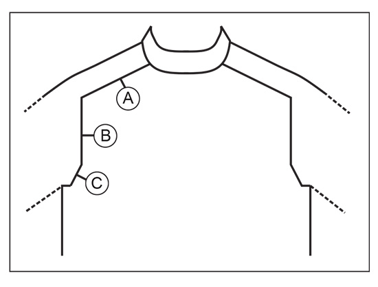 Diagram for DROPS 232-25