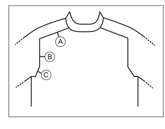 Diagram for DROPS 236-25