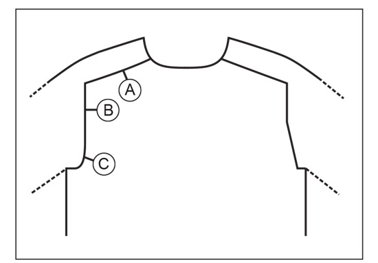 Diagram for DROPS 248-7