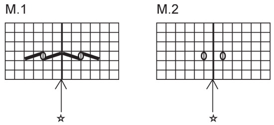Diagram for DROPS 74-11