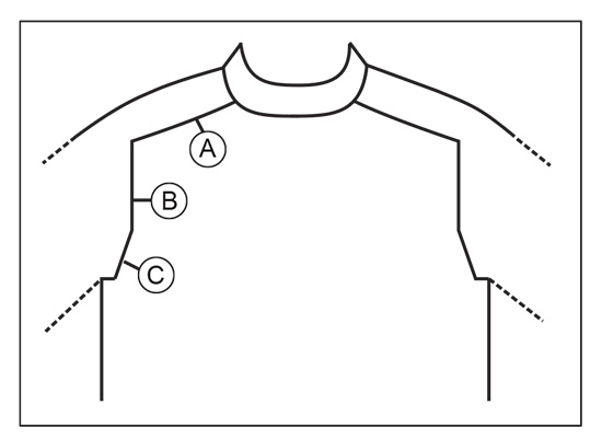 Diagram for DROPS Children 40-14