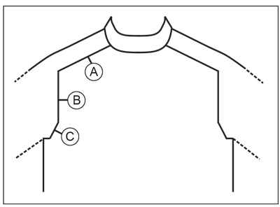 Diagram for DROPS Children 40-19