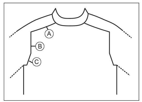 Diagram for DROPS Children 40-20
